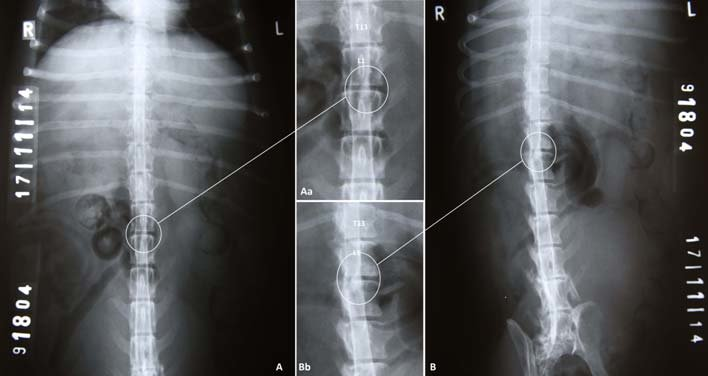 Exame de Mielografia