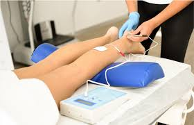 Eletroneuromiografia 